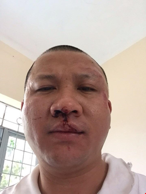 Một phụ nữ bị truy tố vì cướp của đại gia gần 1 tỉ đồng Một phụ nữ bị truy tố vì cướp của đại gia gần 1 tỉ đồng