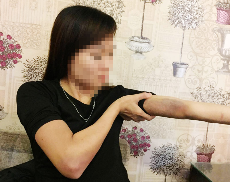 Thanh niên bị “tố” đánh bạn gái tím tay chân từng liên quan án giết người Thanh niên bị “tố” đánh bạn gái tím tay chân từng liên quan án giết người