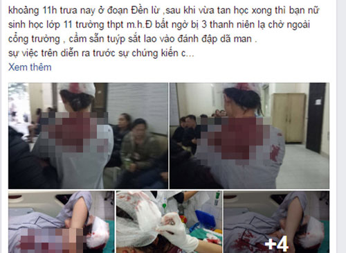Nữ sinh bị đánh rách đầu, gãy tay trên đường đi học về Nữ sinh bị đánh rách đầu, gãy tay trên đường đi học về