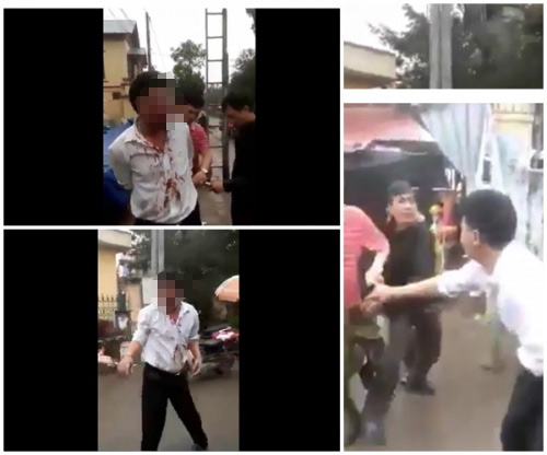 Người đàn ông bị đánh giữa chợ vì nghi bắt cóc trẻ em Người đàn ông bị đánh giữa chợ vì nghi bắt cóc trẻ em