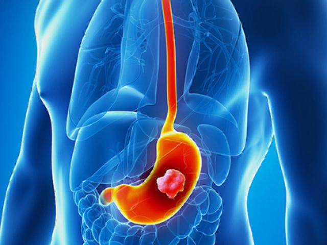 16 thực phẩm quý hơn vàng với người bị bệnh viêm loét dạ dày