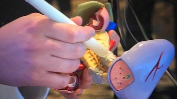 “Bút ung thư” phát hiện ra bệnh ung thư trong chỉ 20 giây - 1