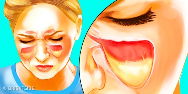 Các phương pháp tự nhiên chữa bệnh hiệu quả hơn cả thuốc kháng sinh - 2
