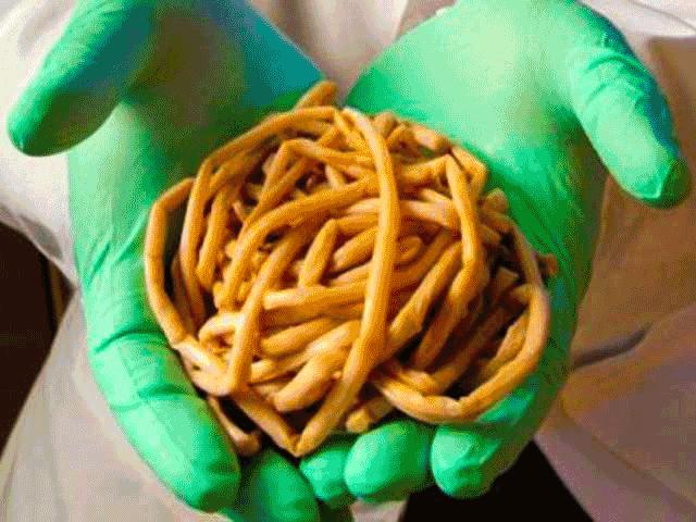 Bó tay toàn tập trước 12 kiểu ăn kiêng kỳ quái nhất lịch sử