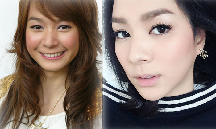 7 mỹ nữ nổi tiếng Thái Lan đẹp nhờ &#34;đập mặt đi xây lại&#34; - 4