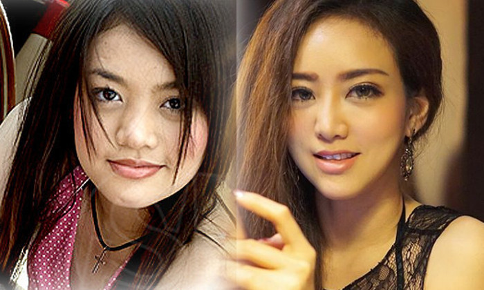 7 mỹ nữ nổi tiếng Thái Lan đẹp nhờ &#34;đập mặt đi xây lại&#34; - 3