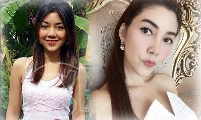 7 mỹ nữ nổi tiếng Thái Lan đẹp nhờ &#34;đập mặt đi xây lại&#34; - 6