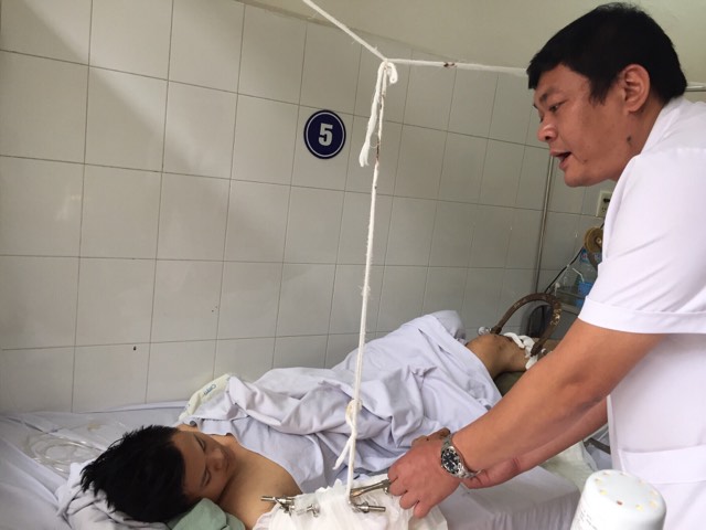 Xót xa nam sinh kiến trúc bị cửa xe khách kẹp đứt lìa cánh tay Xót xa nam sinh kiến trúc bị cửa xe khách kẹp đứt lìa cánh tay