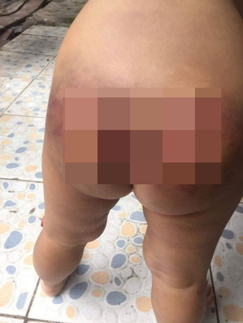 Bình Dương: Nghi án bé trai 2 tuổi bị bạn trai của mẹ bạo hành Bình Dương: Nghi án bé trai 2 tuổi bị bạn trai của mẹ bạo hành