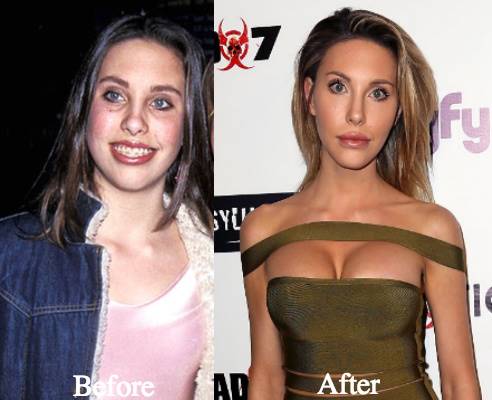 "Con nghiện thẩm mỹ" cắt xương sườn, bơm ngực như bóng bay - 2