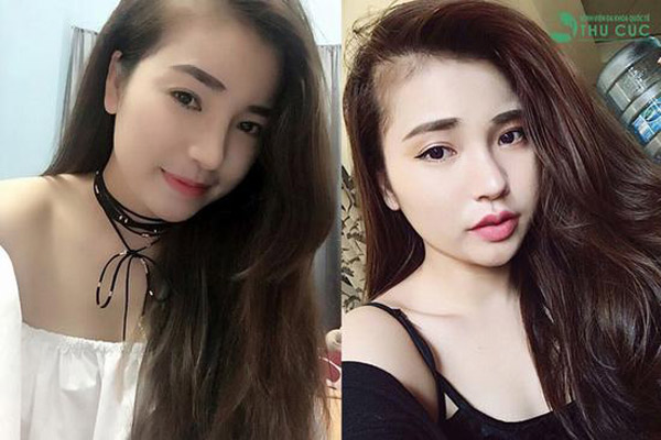 7 bức ảnh sẽ khiến bạn muốn phẫu thuật thẩm mỹ ngay lập tức - 4