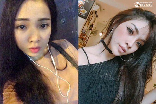 7 bức ảnh sẽ khiến bạn muốn phẫu thuật thẩm mỹ ngay lập tức - 6
