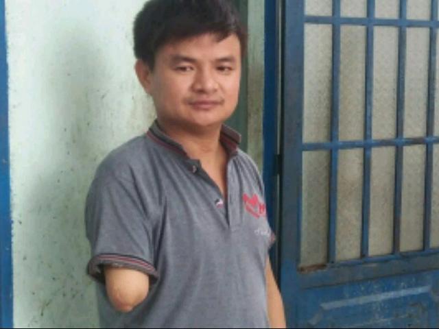 Vụ "đòi đền cánh tay": Tòa đề nghị công an vào cuộc Vụ "đòi đền cánh tay": Tòa đề nghị công an vào cuộc