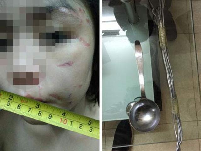 Đau lòng chuyện &#34;bánh đúc có xương&#34;