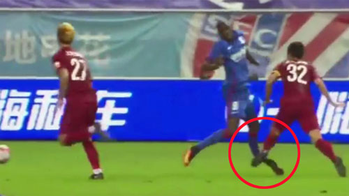 Những chấn thương ghê rợn: Demba Ba “nhập hội” Ronaldo Những chấn thương ghê rợn: Demba Ba “nhập hội” Ronaldo