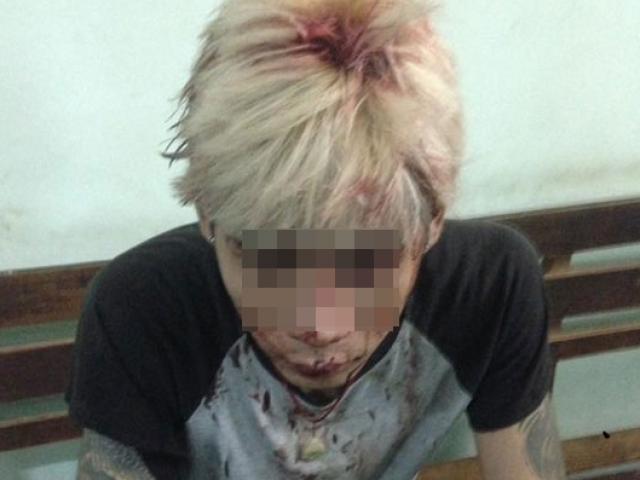 Chuyện đằng sau clip thanh niên đầu chảy máu đòi gặp CSGT