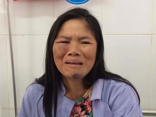Nóng 24h qua: Người bán tăm bật khóc nhớ lại lúc bị vu oan bắt cóc trẻ con Nóng 24h qua: Người bán tăm bật khóc nhớ lại lúc bị vu oan bắt cóc trẻ con