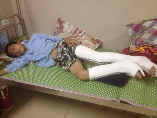 Nóng 24h qua: Đau xót lý do khiến 3 gia đình cưa đầu đạn ở Khánh Hòa - 2
