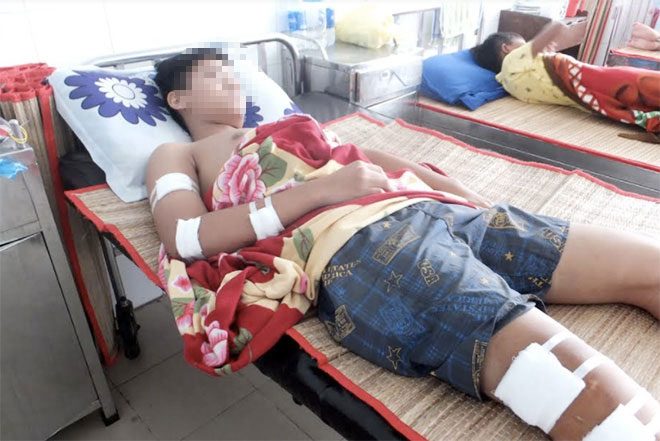 Đang đứng trước nhà, một học sinh lớp 10 bị chém nhập viện Đang đứng trước nhà, một học sinh lớp 10 bị chém nhập viện