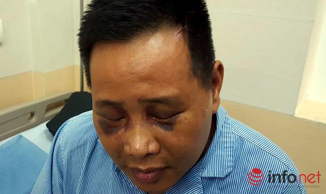 Ngồi uống cà phê với bạn gái, người đàn ông bị đánh chấn thương sọ não Ngồi uống cà phê với bạn gái, người đàn ông bị đánh chấn thương sọ não