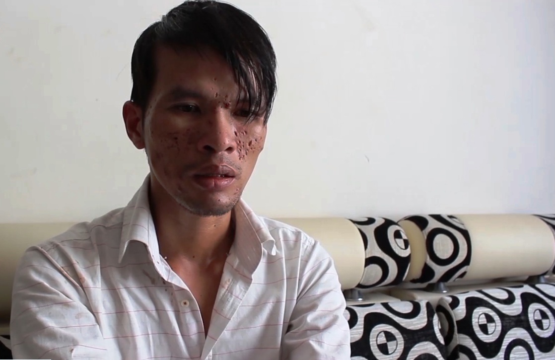 Nghi phạm hành hạ bé trai Campuchia từng quỳ gối xin được tha thứ Nghi phạm hành hạ bé trai Campuchia từng quỳ gối xin được tha thứ