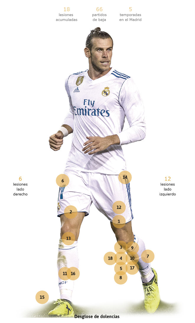 Siêu "thương binh" Real, Gareth Bale: Bóng vàng chưa đến đã lo nghiệp tàn Siêu "thương binh" Real, Gareth Bale: Bóng vàng chưa đến đã lo nghiệp tàn