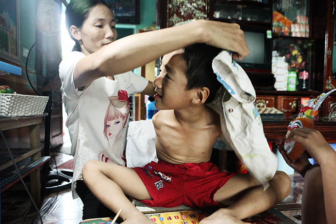 http://image.24h.com.vn/upload/4-2017/images/2017-10-11/1507732673-cau-be-7-tuoi-dep-nhu-thien-than-khong-moc-tay-tu-trong-bung-me-khong-tay-1-1507619684-width660height440.jpg