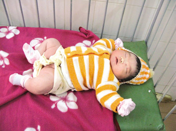 Kinh ngạc trước những em bé vừa chào đời đã có cân nặng “khủng” nhất Việt Nam - 2