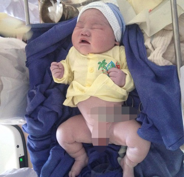 Kinh ngạc trước những em bé vừa chào đời đã có cân nặng “khủng” nhất Việt Nam - 5