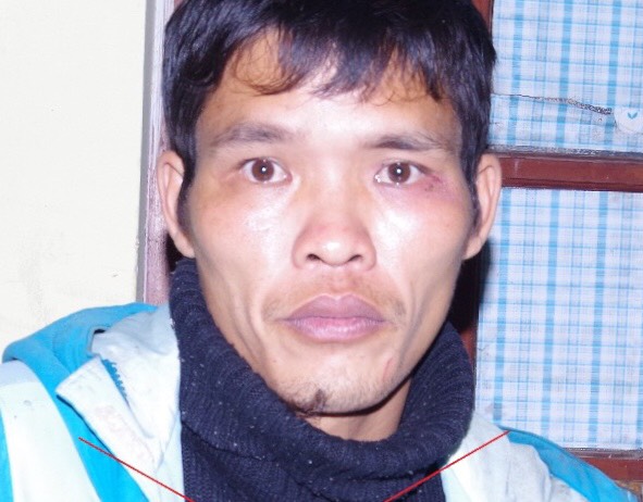 Những sát thủ máu lạnh giết người vì không được "ân ái" Những sát thủ máu lạnh giết người vì không được "ân ái"