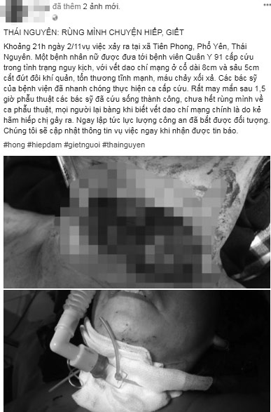 Bà chủ tiệm tóc bị cắt cổ, không mặc quần, lết ra đường kêu cứu Bà chủ tiệm tóc bị cắt cổ, không mặc quần, lết ra đường kêu cứu