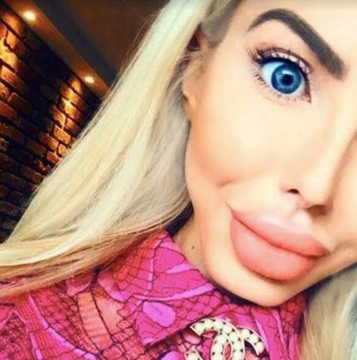 Phát hoảng ngắm búp bê sống Ba Lan sau dao kéo - 5