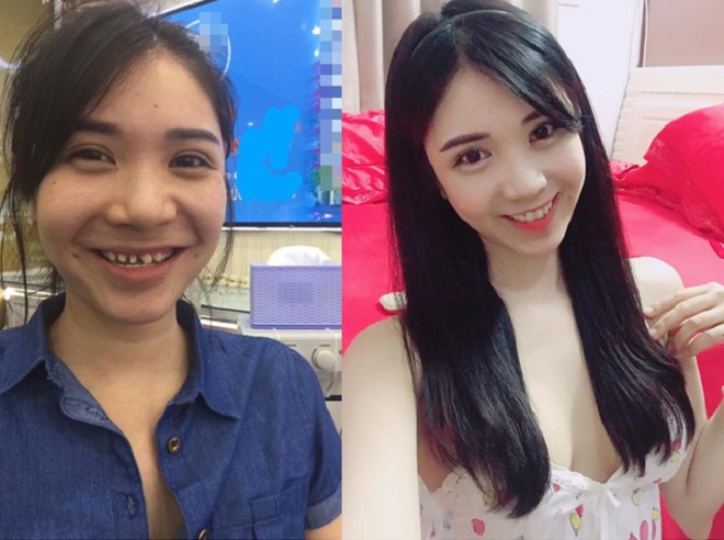 "Bồ thiếu gia Phan Hải" - Thanh Bi tiết lộ cách tăng cỡ vòng 1 - 4