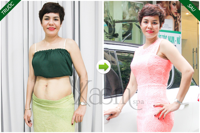 “Bỏ túi” các phương pháp giảm béo nhanh – an toàn, kịp đẹp chơi Tết - 3