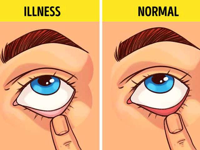 Chẳng cần tới bệnh viện, bạn có thể tự kiểm tra mình mắc bệnh gì với vài động tác này