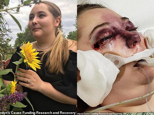 Nữ sinh bị mù bí ẩn sau chuyến du lịch cùng gia đình