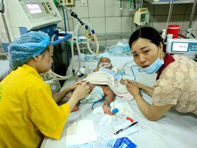 Những sai lầm chết người khiến trẻ mắc sởi bị biến chứng trầm trọng hơn