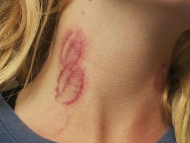 Bạn sẽ không dám “cắn yêu” khi làm “chuyện ấy” nếu biết những điều này