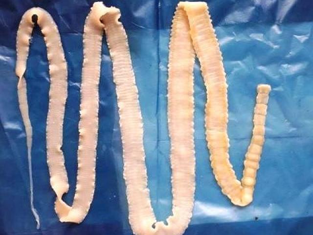Kinh hoàng quá trình phát triển của sán lợn khi vào cơ thể người Kinh hoàng quá trình phát triển của sán lợn khi vào cơ thể người