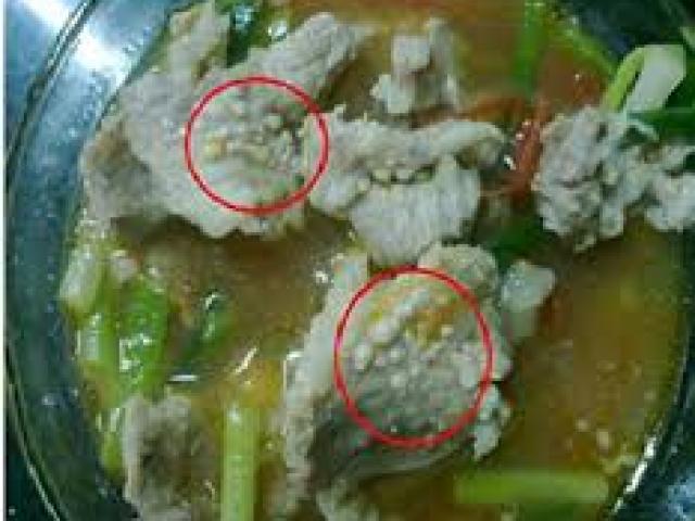 Trẻ nhiễm sán lợn: Hàng nghìn bà mẹ đang hoang mang quá mức Trẻ nhiễm sán lợn: Hàng nghìn bà mẹ đang hoang mang quá mức