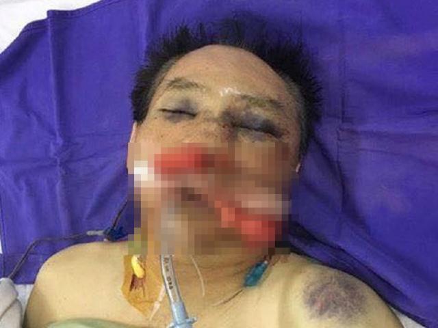 Cựu đại tá công an cùng con trai đánh anh ruột đến chết Cựu đại tá công an cùng con trai đánh anh ruột đến chết