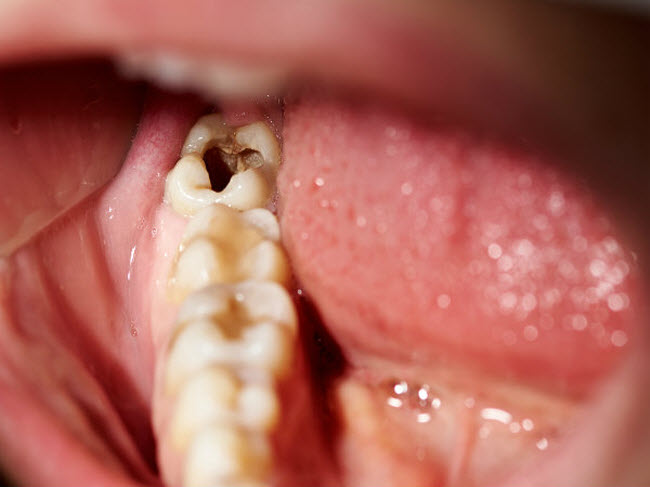 8 dấu hiệu cảnh báo bạn đang ăn quá nhiều đường - 7