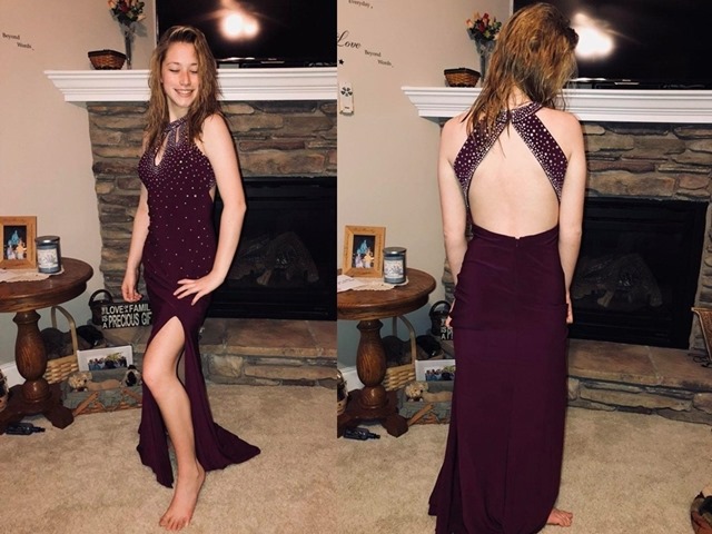 Chia tay bạn trai vì bị chê là gái làng chơi khi mặc váy hở lưng