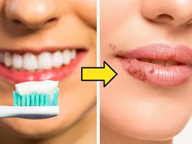 Bị đau răng có thể khiến bạn mắc 6 căn bệnh trầm trọng này