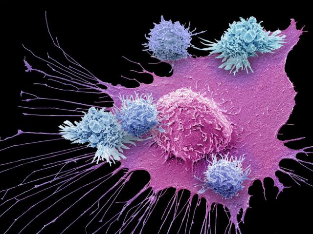 Thực phẩm chống ung thư, tốt cho tim, ở Việt Nam chợ nào cũng bán