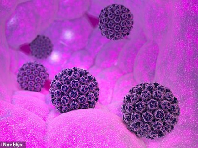 "Lợi dụng" virus đường tình dục, phát hiện ung thư sớm 40 năm "Lợi dụng" virus đường tình dục, phát hiện ung thư sớm 40 năm