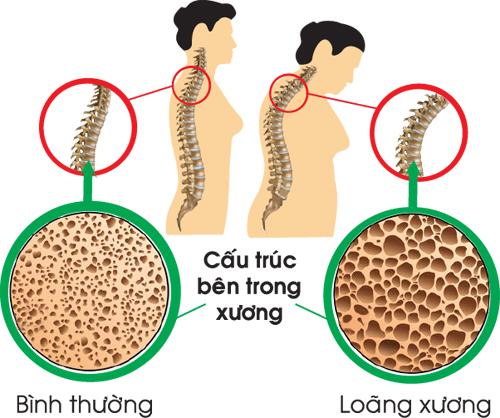 4 nguyên nhân tàn phá xương khớp khủng khiếp, đáng tiếc là dân văn phòng vẫn làm thường xuyên - 1