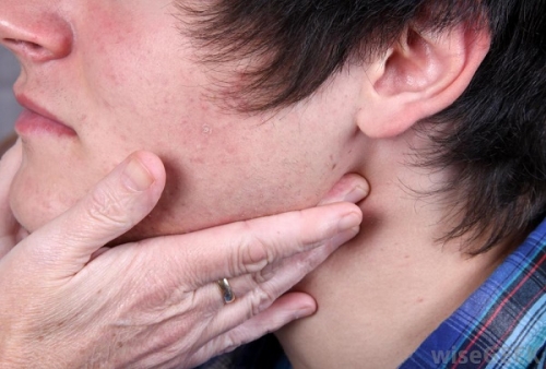 Dấu hiệu nhận biết sớm ung thư vòm họng - 4