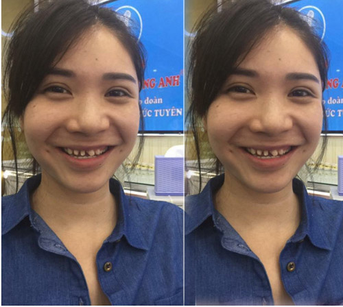 Thanh Bi và dàn sao Việt đẹp bất ngờ nhờ trùng tu bộ phận này! - 1