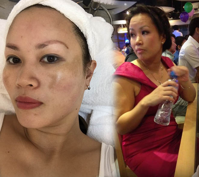 "Tủ lạnh 3 con" Hà thành phẫu thuật từ đầu tới chân để đẹp như thời 20 - 1